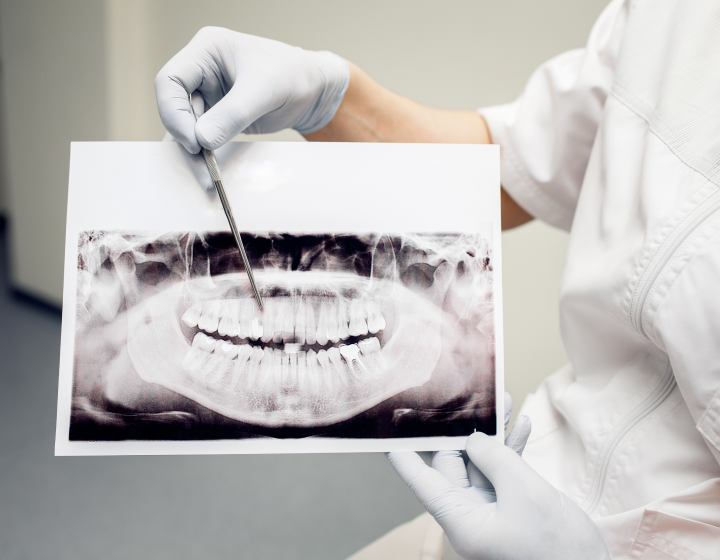 Zanelato Estética Dental | Tratamentos Odontológicos e Odontologia Digital