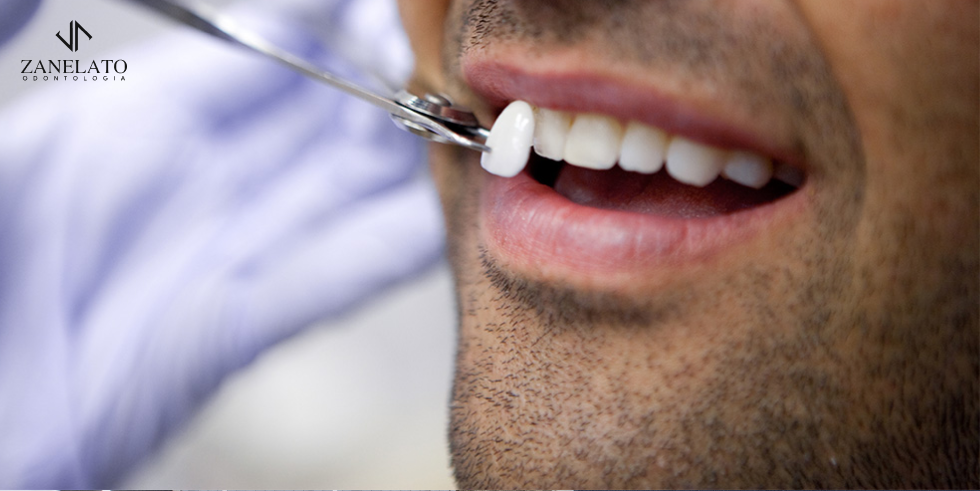 Zanelato Estética Dental | Tratamentos Odontológicos e Odontologia Digital Reabilitação Adesiva: Entenda o Procedimento de Porcelana Zero Desgaste