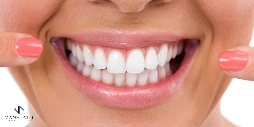 Zanelato Estética Dental | Tratamentos Odontológicos e Odontologia Digital Reabilitação Adesiva: Entenda o Procedimento de Porcelana Zero Desgaste