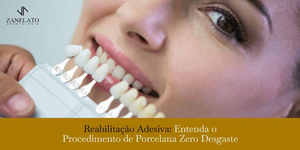 Reabilitação Adesiva: Entenda o Procedimento de Porcelana Zero Desgaste