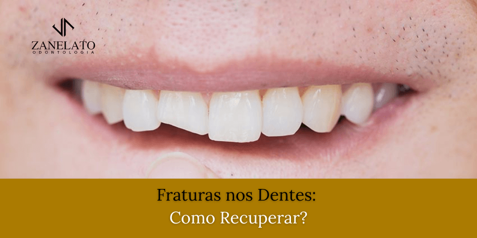Fraturas nos Dentes: Como Recuperar?