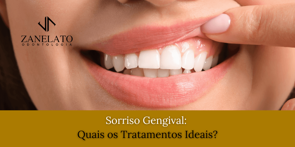 Sorriso Gengival: Quais os Tratamentos Ideais?