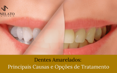 Dentes Amarelados: Principais Causas e Opções de Tratamento