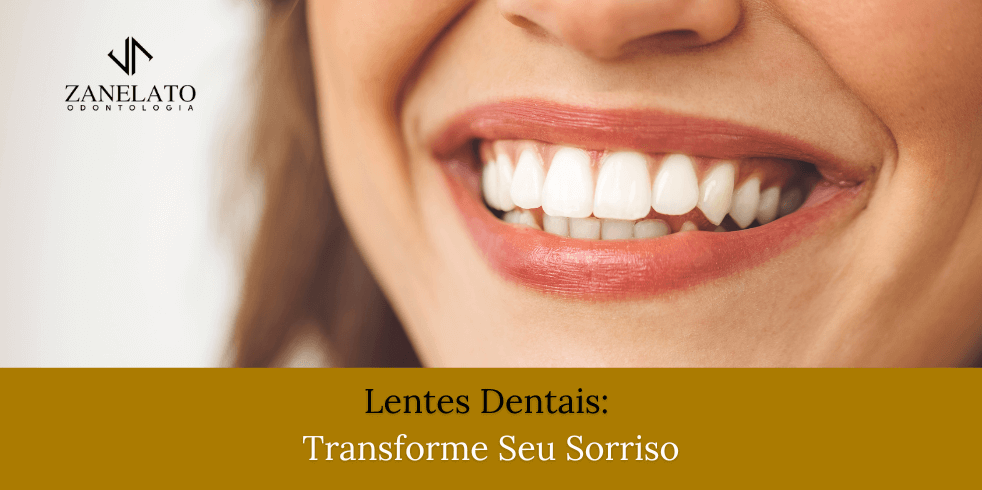 Lentes Dentais: Transforme Seu Sorriso