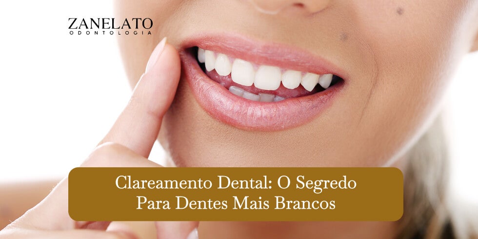 Clareamento Dental: O segredo para dentes mais brancos