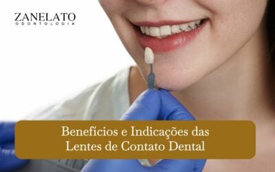 Benefícios e Indicações das Lentes de Contato Dental