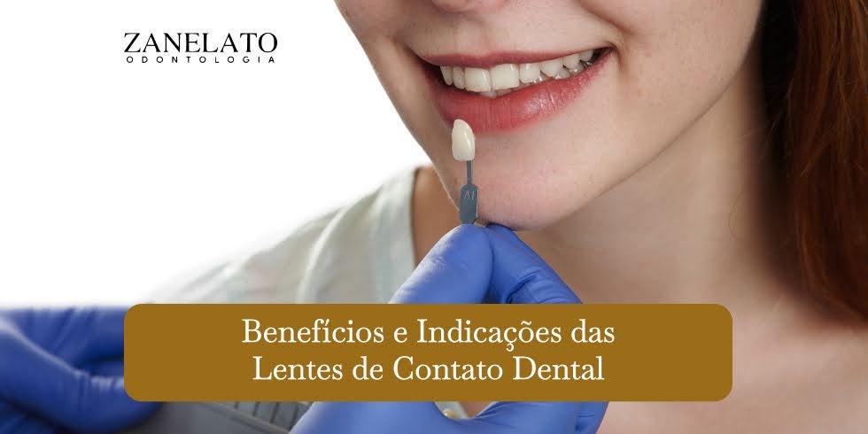 Benefícios e Indicações das Lentes de Contato Dental