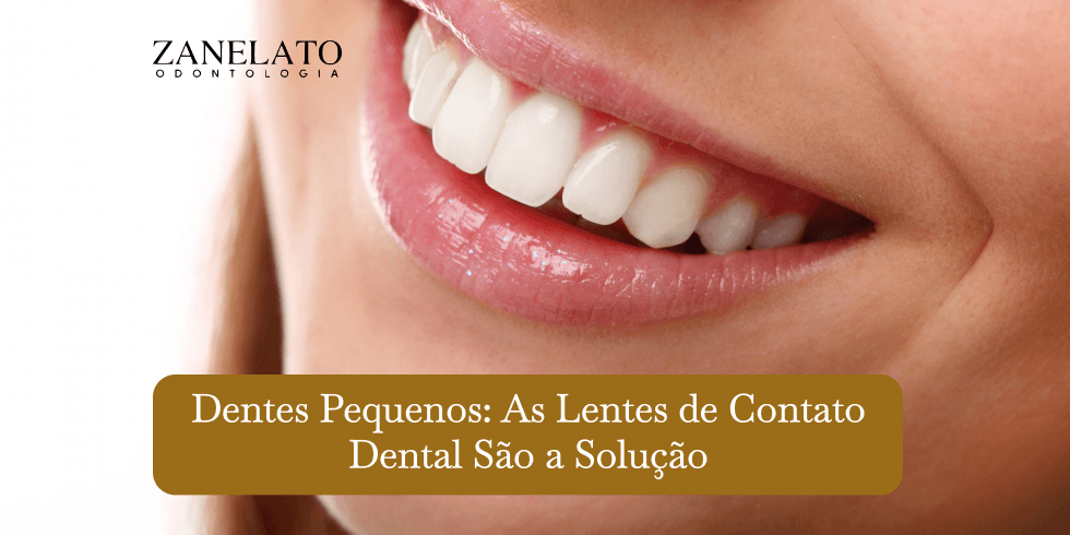 Dentes Pequenos: As Lentes de Contato Dental São a Solução