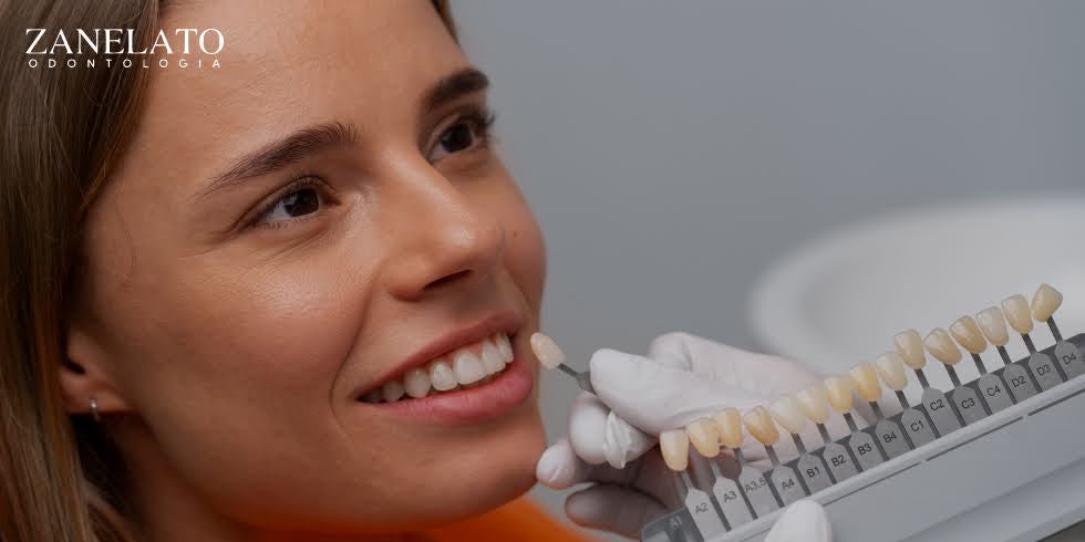 Zanelato Estética Dental | Tratamentos Odontológicos e Odontologia Digital Benefícios e Indicações das Lentes de Contato Dental