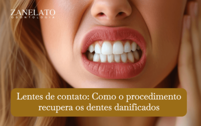 Lentes de Contato: Como o Procedimento Recupera os Dentes Danificados