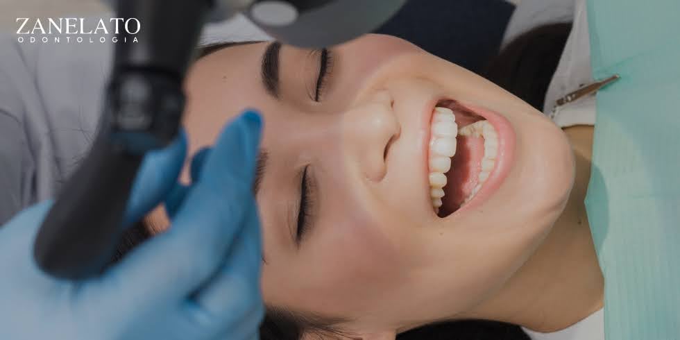 Zanelato Estética Dental | Tratamentos Odontológicos e Odontologia Digital Benefícios e Indicações das Lentes de Contato Dental