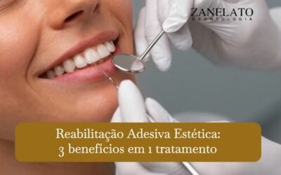 Reabilitação Adesiva Estética: 3 benefícios em 1 tratamento