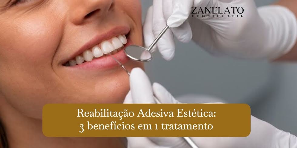 Reabilitação Adesiva Estética: 3 benefícios em 1 tratamento
